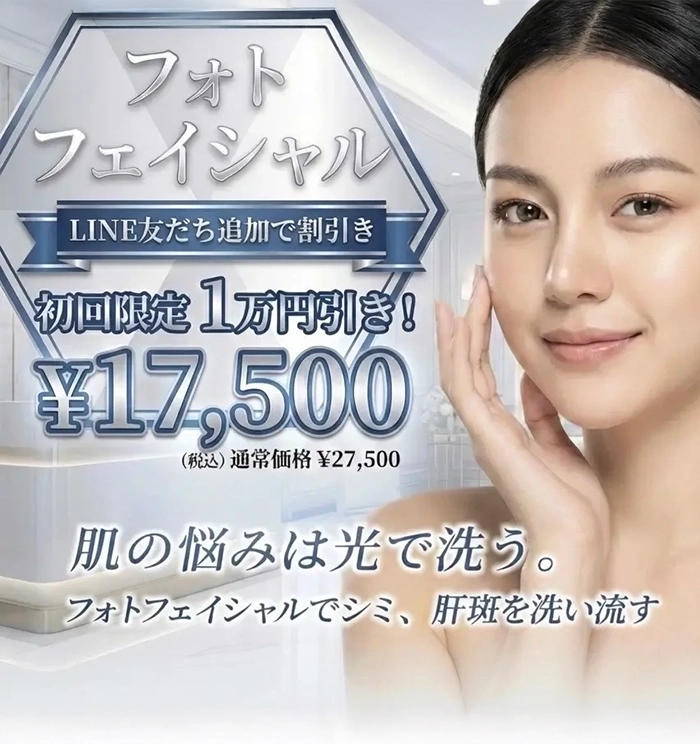 フォトフェイシャルステラM22/M22