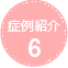 photofacial_cace_6