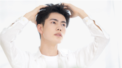 男性型脱毛症