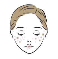 フラクショナルルビーレーザーが有効な治療